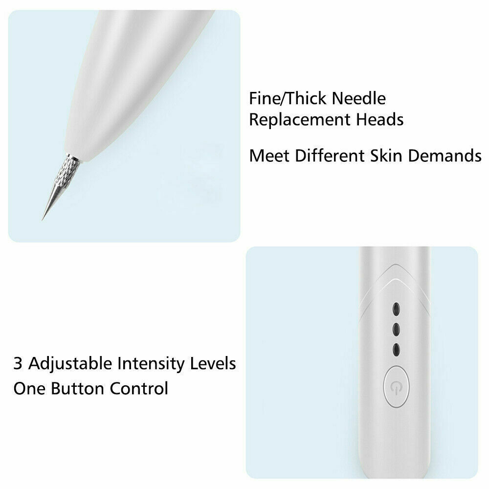 Ion Laser Freckle Mole Spot Remover